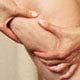 photo de la cellulite
